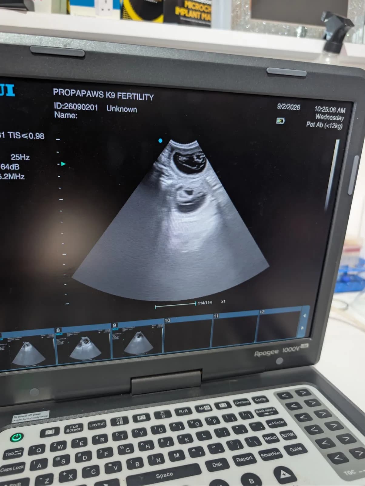 Coco's scan, 2 September 2026