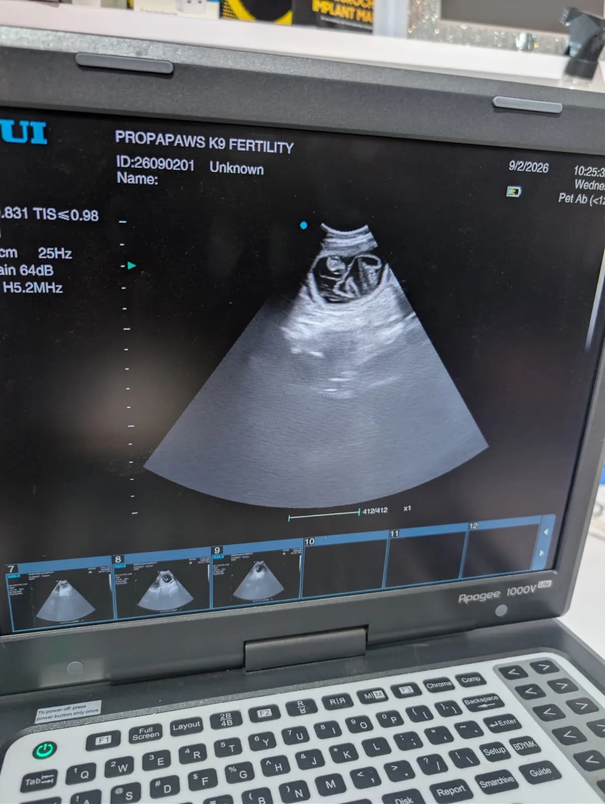 Coco's scan, 2 September 2026